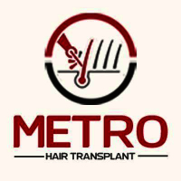  Metro Hair Transplant Centre in Ambala HR
