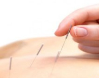  Weight, Hair & Pain Care Acupuncture in Fairfield NSW